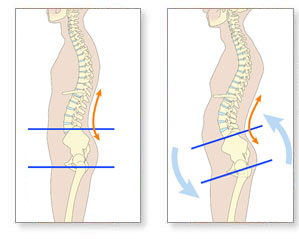 Muscle Imbalances